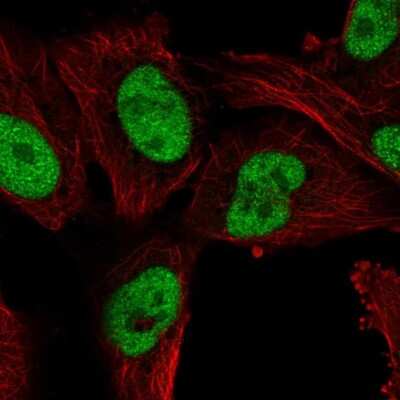Immunocytochemistry/ Immunofluorescence: TC-PTP/PTPN2 Antibody [NBP2-48528]