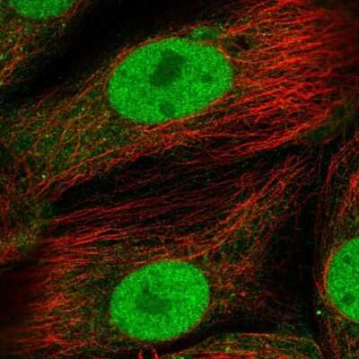 Immunocytochemistry/ Immunofluorescence: TC-PTP/PTPN2 Antibody [NBP2-48841]