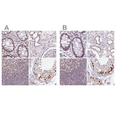 Immunohistochemistry-Paraffin: TC-PTP/PTPN2 Antibody [NBP2-48528]