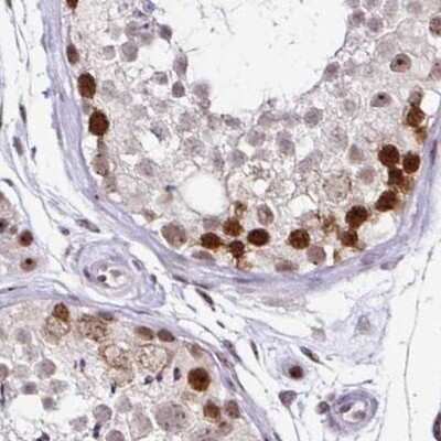 Immunohistochemistry-Paraffin: TC-PTP/PTPN2 Antibody [NBP2-48841]
