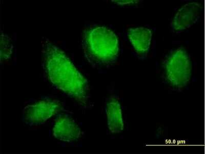 Immunocytochemistry/ Immunofluorescence: TC10 Antibody [H00023433-B01P]