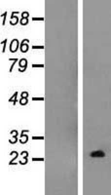 Western Blot: TC10 Overexpression Lysate [NBL1-15359]