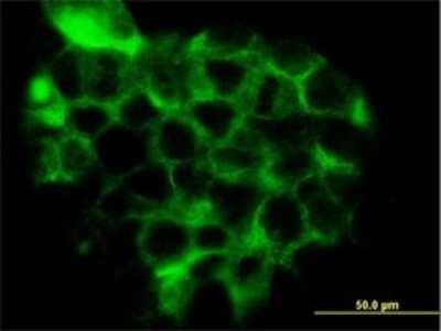 Immunocytochemistry/ Immunofluorescence: TC21/R-Ras2 Antibody (2D3-4B8) [H00022800-M01]