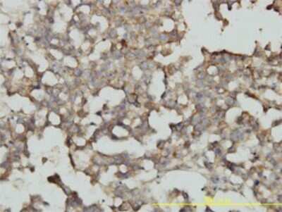 Immunohistochemistry-Paraffin: TC21/R-Ras2 Antibody (2D3-4B8) [H00022800-M01]