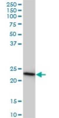 Western Blot: TC21/R-Ras2 Antibody (2D3-4B8) [H00022800-M01]