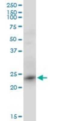 Western Blot: TC21/R-Ras2 Antibody (2D3-4B8) [H00022800-M01]