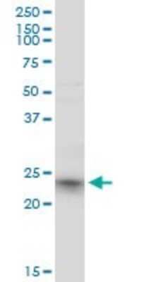Western Blot: TC21/R-Ras2 Antibody (2D3-4B8) [H00022800-M01]
