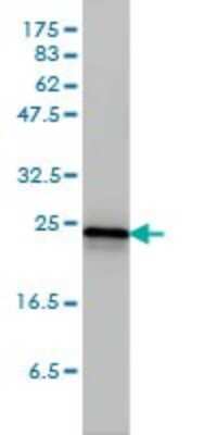Western Blot: TC21/R-Ras2 Antibody (2D3-4B8) [H00022800-M01]