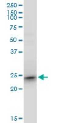 Western Blot: TC21/R-Ras2 Antibody (2D3-4B8) [H00022800-M01]