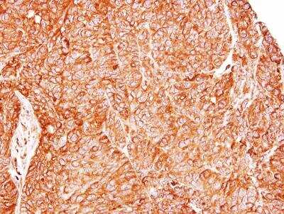 Immunohistochemistry-Paraffin: TC21/R-Ras2 Antibody [NBP1-32919]