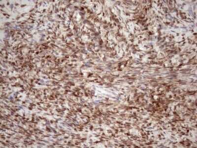 Immunohistochemistry: TCEAL1 Antibody (OTI2G10) [NBP2-46085]