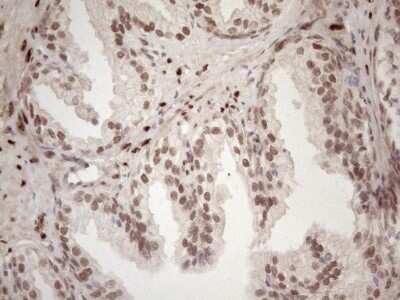 Immunohistochemistry: TCEAL1 Antibody (OTI2G10) [NBP2-46085]