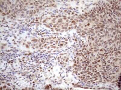 Immunohistochemistry: TCEAL1 Antibody (OTI2G10) [NBP2-46085]