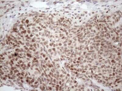 Immunohistochemistry: TCEAL1 Antibody (OTI2G10) - Azide and BSA Free [NBP2-74472]