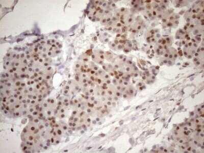 Immunohistochemistry: TCEAL1 Antibody (OTI2G10) - Azide and BSA Free [NBP2-74472]