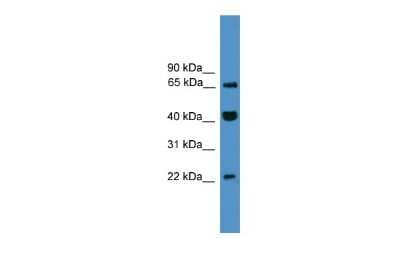 Western Blot: TCEAL6 Antibody [NBP2-84294]