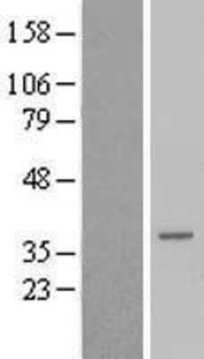 Western Blot: TCEAL6 Overexpression Lysate [NBP2-08836]