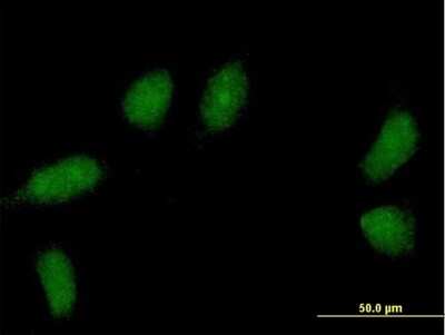 Immunocytochemistry/ Immunofluorescence: TCEANC2 Antibody [H00127428-B01P]