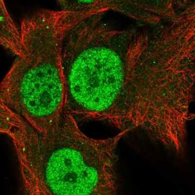 Immunocytochemistry/ Immunofluorescence: TCEANC2 Antibody [NBP2-13419]