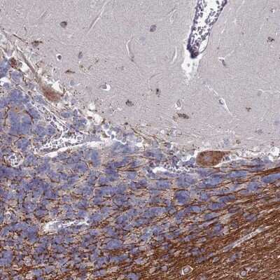 Immunohistochemistry-Paraffin: TCEANC2 Antibody [NBP2-13419]