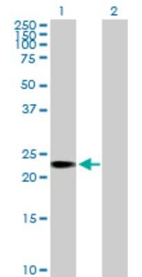 Western Blot: TCEANC2 Antibody [H00127428-B01P]