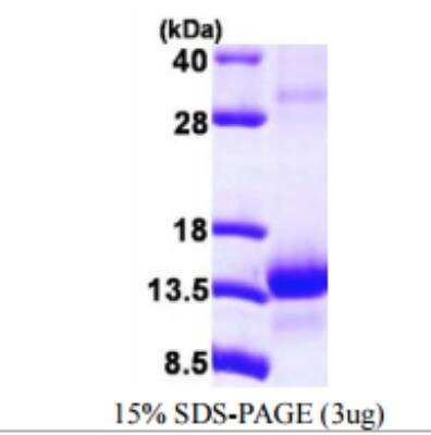 SDS-PAGE: Recombinant Human TCEB1 His Protein [NBP1-78862]