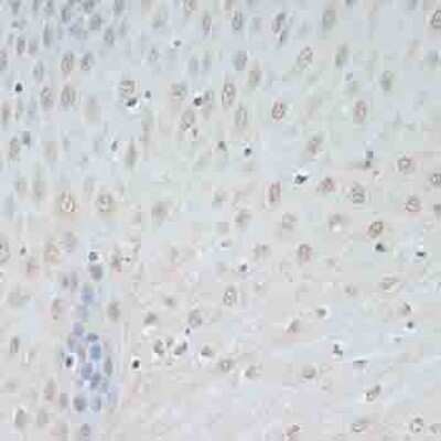 Immunohistochemistry-Paraffin: TCEB2 Antibody - BSA Free [NBP2-94034]