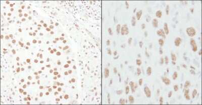 Immunohistochemistry-Paraffin: TCERG1 Antibody [NB300-214]