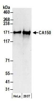 Western Blot: TCERG1 Antibody [NB300-214]