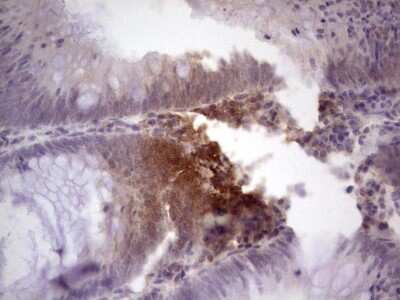 Immunohistochemistry: TCF-12/HTF4 Antibody (OTI4D6) [NBP2-46086]