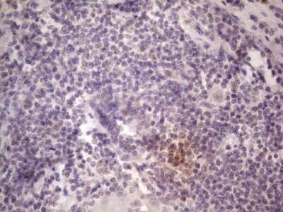 Immunohistochemistry: TCF-12/HTF4 Antibody (OTI4D6) - Azide and BSA Free [NBP2-74473]