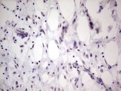 Immunohistochemistry: TCF-12/HTF4 Antibody (OTI4D6) - Azide and BSA Free [NBP2-74473]