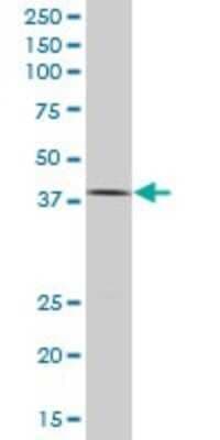 Western Blot: TCF-2/HNF-1 beta Antibody (4E9) [H00006928-M06]