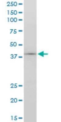 Western Blot: TCF-2/HNF-1 beta Antibody (4E9) [H00006928-M06]