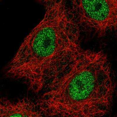 Immunocytochemistry/ Immunofluorescence: TCF-2/HNF-1 beta Antibody (CL0374) [NBP2-30678]