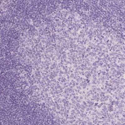Immunohistochemistry-Paraffin: TCF-2/HNF-1 beta Antibody (CL0374) [NBP2-30678]