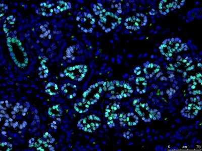 Immunohistochemistry-Paraffin: TCF-2/HNF-1 beta Antibody [NBP1-89680]
