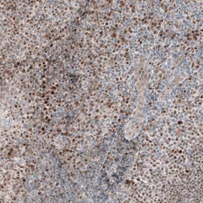 Immunohistochemistry-Paraffin: TCF-3/E2A Antibody [NBP2-38611]