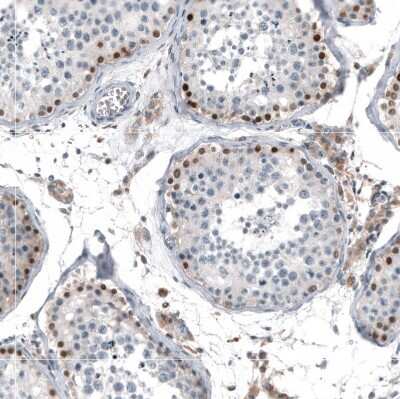 Immunohistochemistry-Paraffin: TCF-3/E2A Antibody [NBP2-38611]