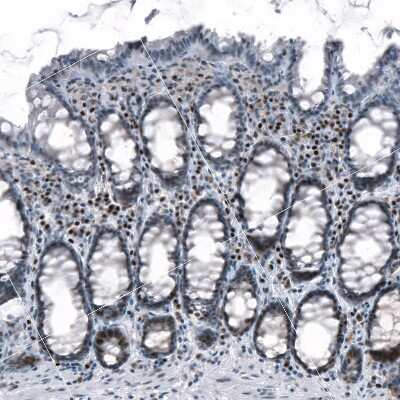 Immunohistochemistry-Paraffin: TCF-3/E2A Antibody [NBP2-38611]