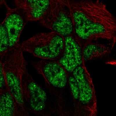 Immunocytochemistry/ Immunofluorescence: TCF15 Antibody [NBP2-55818]