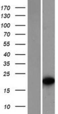 Western Blot: TCF15 Overexpression Lysate [NBP2-07847]