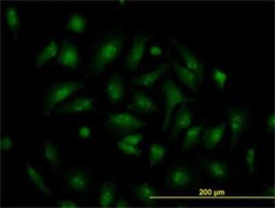 Immunocytochemistry/ Immunofluorescence: TCF19 Antibody (6D8) [H00006941-M01]