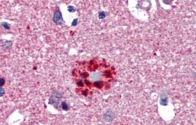 Immunohistochemistry: TCF21 Antibody [NBP2-83632]