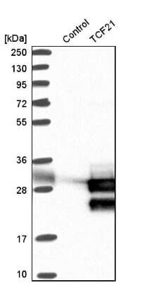 Western Blot: 0 [NBP1-88637]