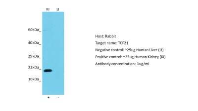 Western Blot: TCF21 Antibody [NBP2-83632]