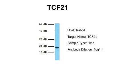 Western Blot: TCF21 Antibody [NBP2-83632]