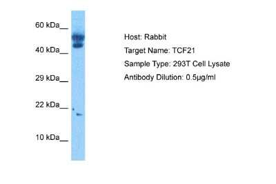 Western Blot: TCF21 Antibody [NBP2-83632]