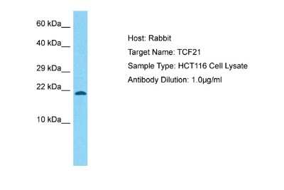 Western Blot: TCF21 Antibody [NBP2-83632]