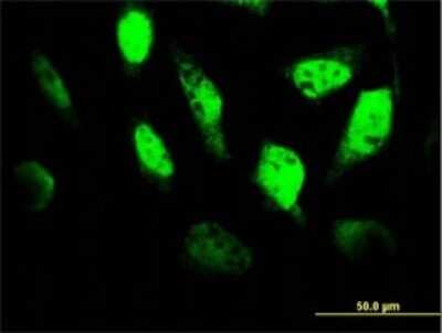 Immunocytochemistry/ Immunofluorescence: TCF4 Antibody (1G4) [H00006925-M03]
